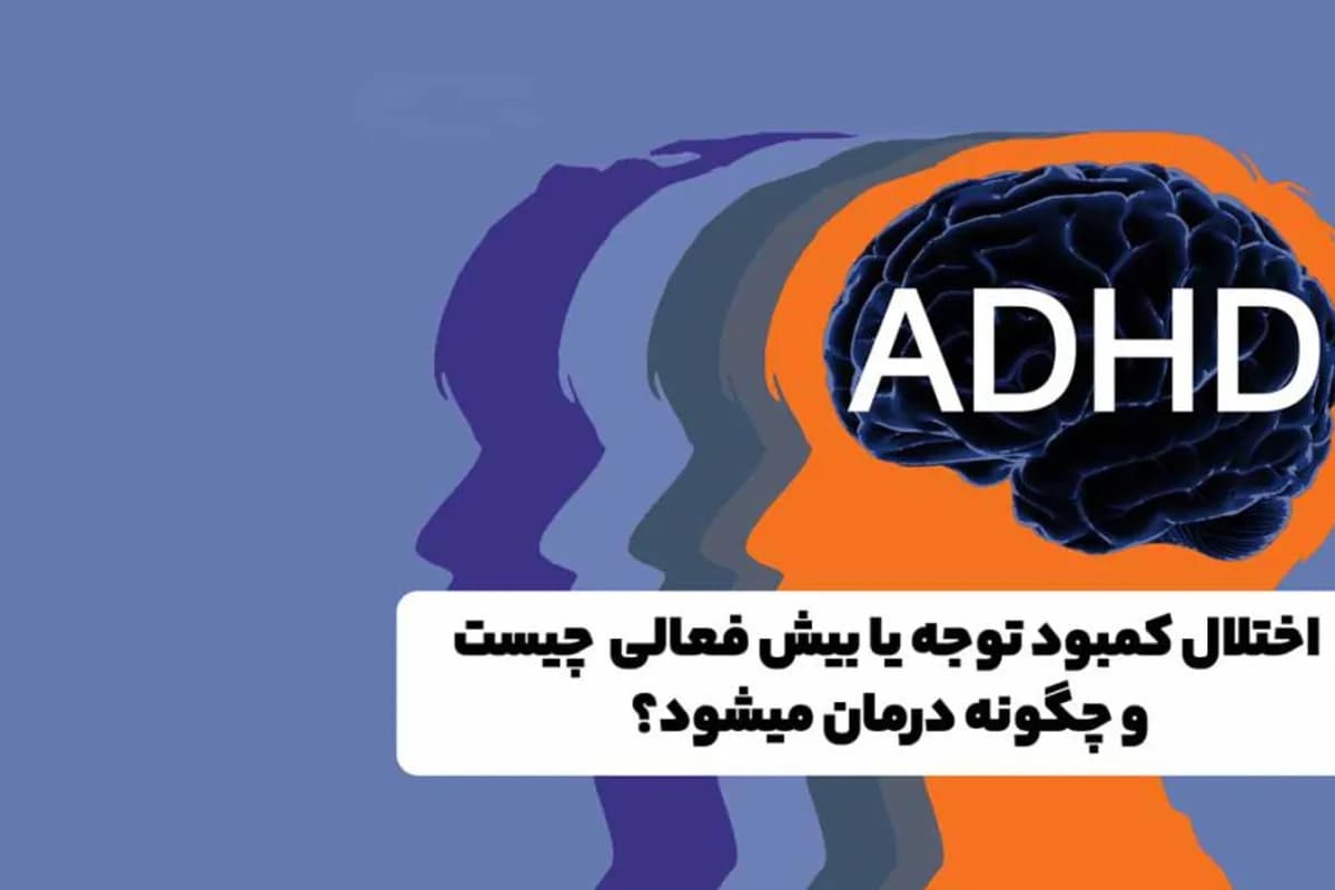https://s2.webstatic.net/post/attention-deficit-hyperactivity-disorder-adhd/17640797358043f8-1200x800.webp